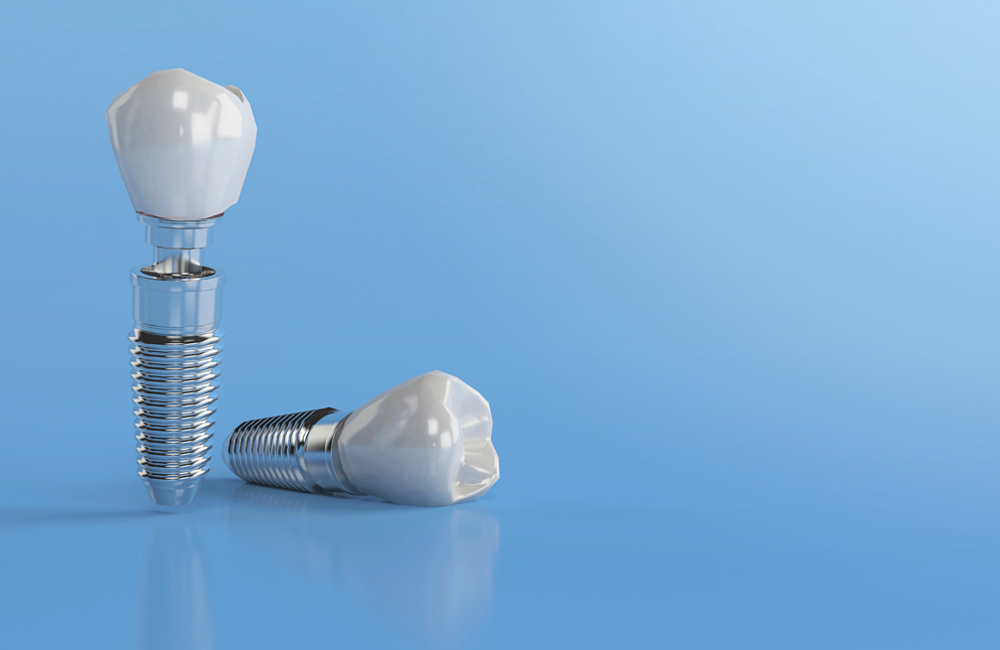 IMPLANTES DENTALES-1000
